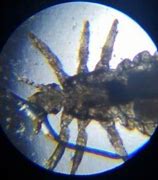 three skips of a louse